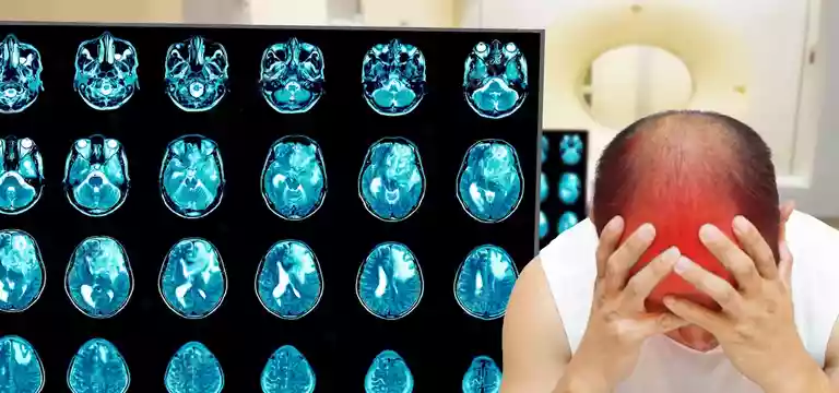 MRI Brain Epilepsy Protocol: Things to Know About